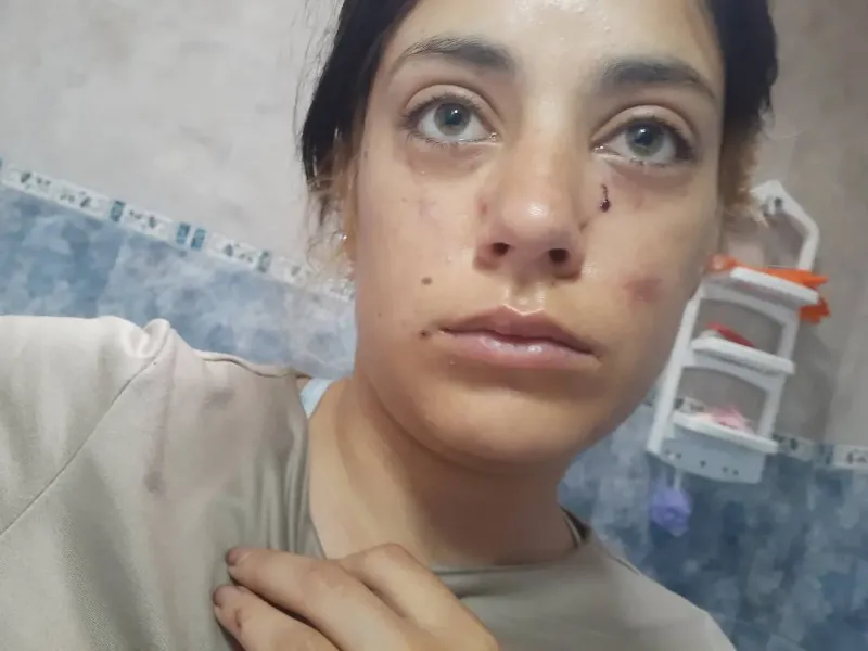 Un joven denunció haber sido agredida brutalmente en La Plata